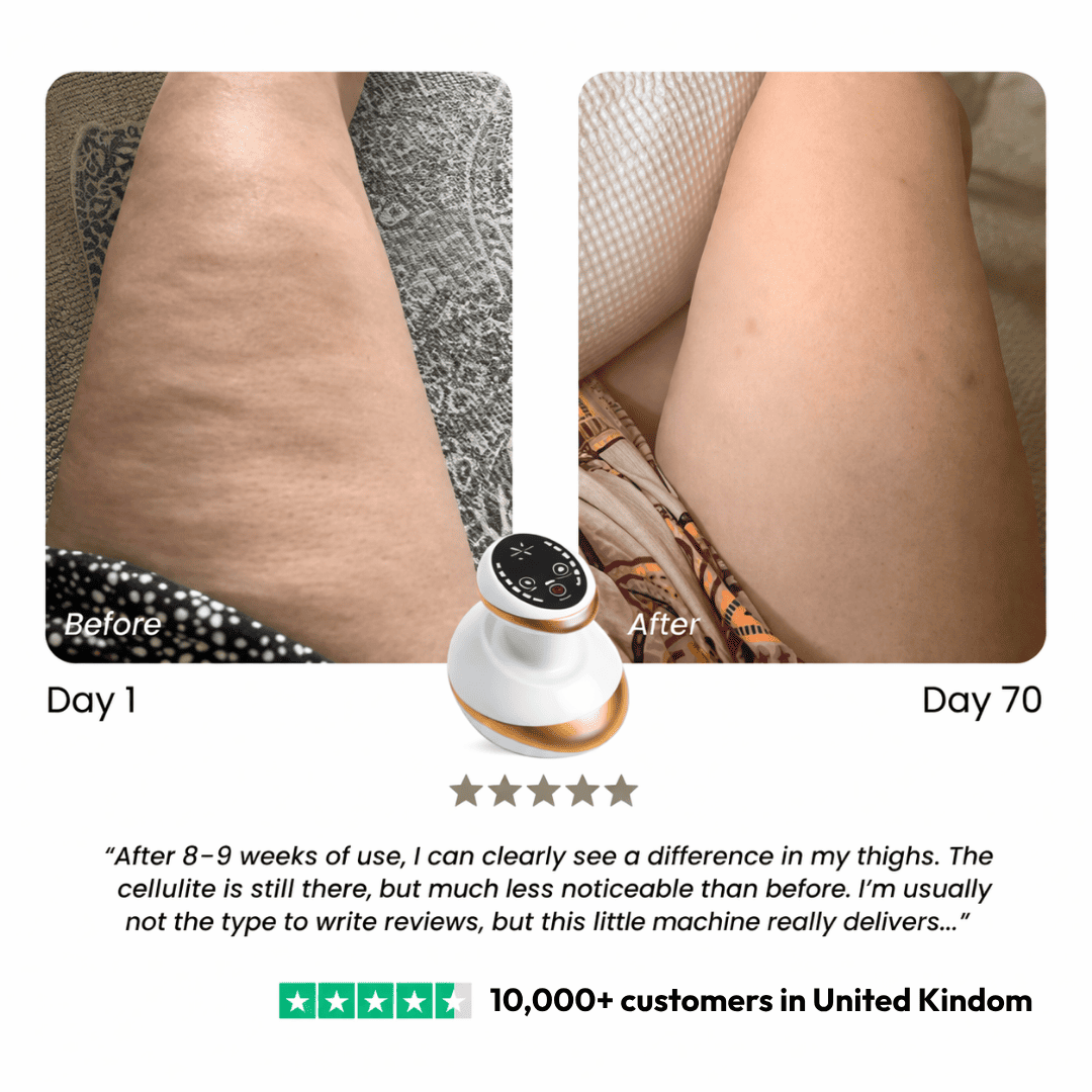 Anti-Cellulite Massage Device