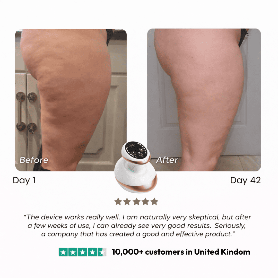 Anti-Cellulite Massage Device